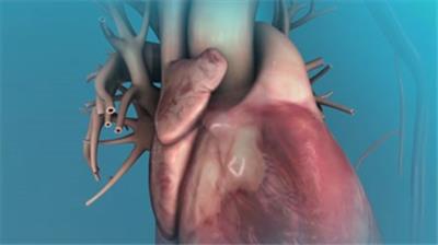  3d心脏电复律医疗视频