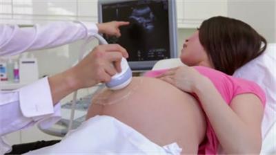  孕妇产检分娩母爱婴儿出生小孩婴幼儿母婴产品
